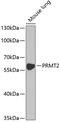 Protein Arginine Methyltransferase 2 antibody, 19-890, ProSci, Western Blot image 