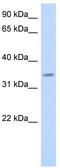 Progestin And AdipoQ Receptor Family Member 6 antibody, TA338688, Origene, Western Blot image 