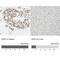 SUFU Negative Regulator Of Hedgehog Signaling antibody, NBP1-87384, Novus Biologicals, Immunohistochemistry paraffin image 