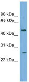 H2.0-like homeobox protein antibody, TA344489, Origene, Western Blot image 