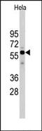 Cell Division Cycle 25A antibody, AP13255PU-N, Origene, Western Blot image 