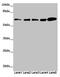 Zinc Finger And BTB Domain Containing 46 antibody, LS-C682279, Lifespan Biosciences, Western Blot image 