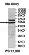 Eukaryotic Translation Initiation Factor 2 Subunit Gamma antibody, orb78258, Biorbyt, Western Blot image 