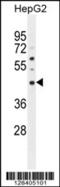 Spermidine/Spermine N1-Acetyl Transferase Like 1 antibody, 55-583, ProSci, Western Blot image 