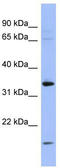 Pyrroline-5-Carboxylate Reductase 1 antibody, TA344625, Origene, Western Blot image 