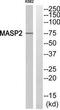 Mannan Binding Lectin Serine Peptidase 2 antibody, TA315101, Origene, Western Blot image 