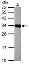 HLA class II histocompatibility antigen, DRB1-16 beta chain antibody, PA5-28156, Invitrogen Antibodies, Western Blot image 