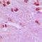 Ribosomal Protein L26 Like 1 antibody, GTX55951, GeneTex, Immunohistochemistry paraffin image 