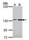 Cell adhesion molecule-related/down-regulated by oncogenes antibody, PA5-28245, Invitrogen Antibodies, Western Blot image 