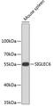 Sialic Acid Binding Ig Like Lectin 6 antibody, 23-756, ProSci, Western Blot image 