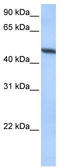 ADAM Metallopeptidase Domain 33 antibody, TA339550, Origene, Western Blot image 