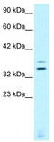 Visual system homeobox 2 antibody, TA329721, Origene, Western Blot image 