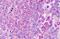 C-C Motif Chemokine Ligand 20 antibody, MBS245814, MyBioSource, Immunohistochemistry paraffin image 