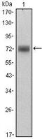 Zinc Finger And BTB Domain Containing 16 antibody, MA5-15667, Invitrogen Antibodies, Western Blot image 