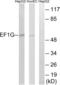 Elongation factor 1-gamma antibody, abx014450, Abbexa, Western Blot image 