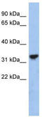 Cytochrome C1 antibody, TA340034, Origene, Western Blot image 