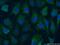 CaM Kinase Like Vesicle Associated antibody, 14788-1-AP, Proteintech Group, Immunofluorescence image 