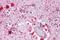 Piwi Like RNA-Mediated Gene Silencing 2 antibody, TA319953, Origene, Immunohistochemistry paraffin image 