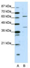 Forkhead box protein P4 antibody, TA345501, Origene, Western Blot image 