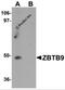 Zinc Finger And BTB Domain Containing 9 antibody, 6131, ProSci, Western Blot image 
