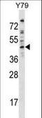 Dematin Actin Binding Protein antibody, LS-C167783, Lifespan Biosciences, Western Blot image 