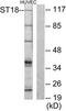 Suppression of tumorigenicity 18 protein antibody, TA314960, Origene, Western Blot image 