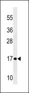 NADH:Ubiquinone Oxidoreductase Subunit A12 antibody, 60-092, ProSci, Western Blot image 