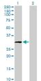 HAUS Augmin Like Complex Subunit 1 antibody, H00115106-B01P, Novus Biologicals, Western Blot image 