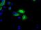 3-Hydroxybutyrate Dehydrogenase 2 antibody, GTX84833, GeneTex, Immunofluorescence image 