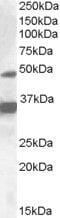 Nuclear Receptor Subfamily 1 Group I Member 2 antibody, PA5-19080, Invitrogen Antibodies, Western Blot image 