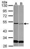 Secreted frizzled-related sequence protein 4 antibody, PA5-29391, Invitrogen Antibodies, Western Blot image 