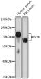 Vitronectin antibody, 16-704, ProSci, Western Blot image 