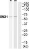 Sorting nexin-1 antibody, TA314553, Origene, Western Blot image 