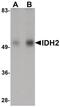 Isocitrate Dehydrogenase (NADP(+)) 2, Mitochondrial antibody, PA5-20977, Invitrogen Antibodies, Western Blot image 