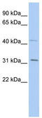 SIX Homeobox 1 antibody, TA330272, Origene, Western Blot image 