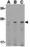 Adiponectin, C1Q And Collagen Domain Containing antibody, GTX31718, GeneTex, Western Blot image 