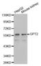 Glutamic--Pyruvic Transaminase 2 antibody, abx001927, Abbexa, Western Blot image 