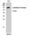 Serine/threonine-protein kinase ICK antibody, A06270Y159, Boster Biological Technology, Western Blot image 