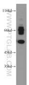 Solute Carrier Family 18 Member A2 antibody, 20873-1-AP, Proteintech Group, Western Blot image 
