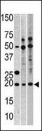 Ribosomal Protein L23a antibody, PA5-11773, Invitrogen Antibodies, Western Blot image 
