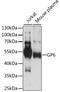 GP6 antibody, LS-C749973, Lifespan Biosciences, Western Blot image 