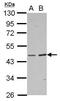 Bile acid-CoA:amino acid N-acyltransferase antibody, PA5-29060, Invitrogen Antibodies, Western Blot image 