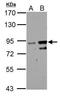 Zinc Finger Protein 598 antibody, GTX119246, GeneTex, Western Blot image 