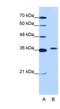 Exosome Component 7 antibody, NBP1-57199, Novus Biologicals, Western Blot image 