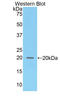 Collagen alpha-2(VIII) chain antibody, LS-C299754, Lifespan Biosciences, Western Blot image 