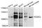 Diacylglycerol Kinase Theta antibody, STJ23374, St John