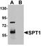 Dual specificity tyrosine-phosphorylation-regulated kinase 1A antibody, orb75594, Biorbyt, Western Blot image 