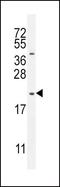 Somatoliberin antibody, GTX81311, GeneTex, Western Blot image 