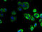 Elongation of very long chain fatty acids protein 1 antibody, A58922-100, Epigentek, Immunofluorescence image 
