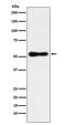 RAR Related Orphan Receptor B antibody, M09711-1, Boster Biological Technology, Western Blot image 